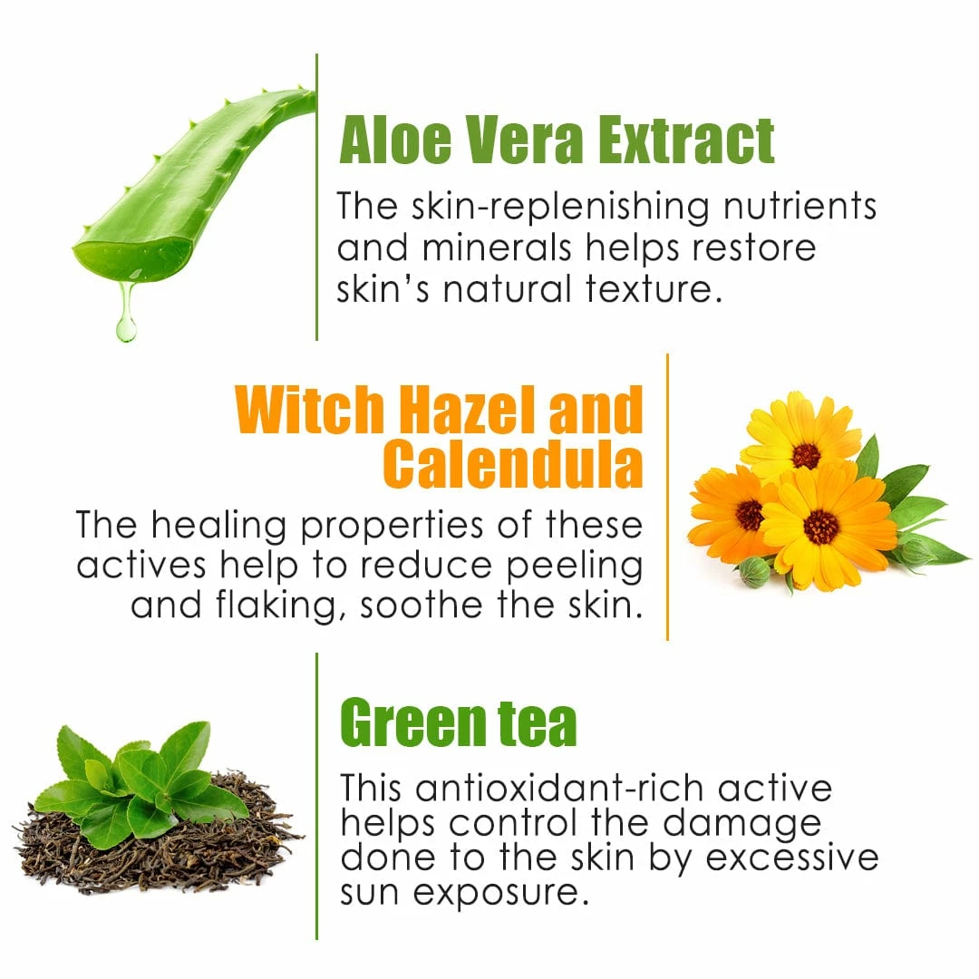 WOW Skin Science Aloe Vera With Hyaluronic Acid, Witch Hazel Extract, Green Tea & Calendula Hydrating After Sun Soothing Gel - No Parabens, Silicones & Color