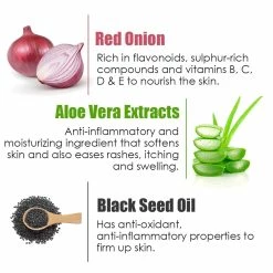 WOW Skin Science Red Onion Skin Mist Toner With Red Onion Seed, Witch Hazel & Aloe Vera Extracts, Black Seed Oil - For All Skin Types